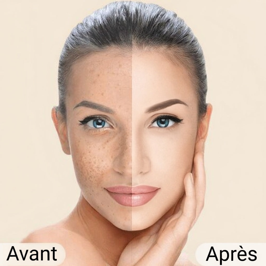 Perfect Cover Concealer - Atmungsaktive Formel